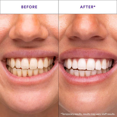 Boost Your Confidence with a Dazzling Smile!